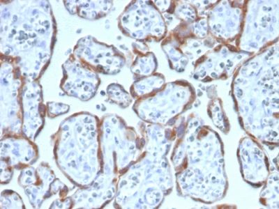 PAPP-A / Pappalysin-1 Monoclonal Mouse Antibody (PAPPA/2717)