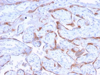 PAPP-A / Pappalysin-1 Monoclonal Mouse Antibody (PAPPA/2718)