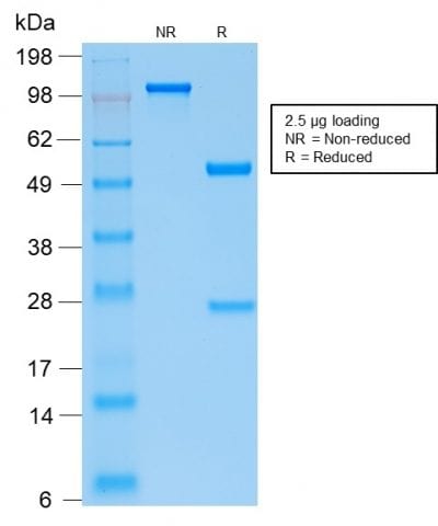Parathyroid Hormone Recombinant Monoclonal Rabbit Antibody (PTH/2295R)