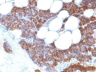 Parathyroid Hormone Recombinant Monoclonal Rabbit Antibody (PTH/2295R)