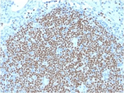 PAX5 / BSAP Monoclonal Mouse Antibody (PAX5/2595)