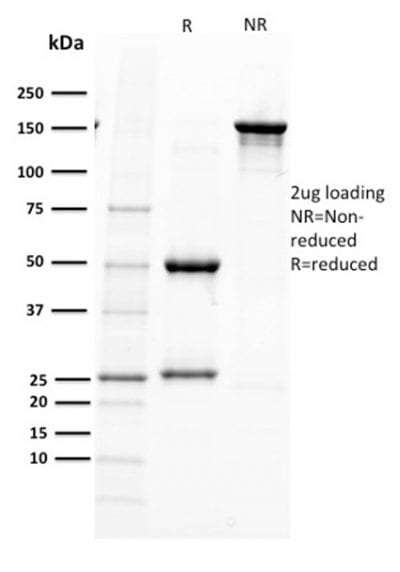 PAX5 / BSAP Monoclonal Mouse Antibody (PAX5/2595)