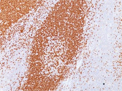 PAX5 / BSAP Monoclonal Mouse Antibody (PAX5/3735)