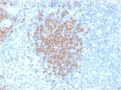 PAX5 / BSAP Monoclonal Mouse Antibody (PCRP-PAX5-1B1)