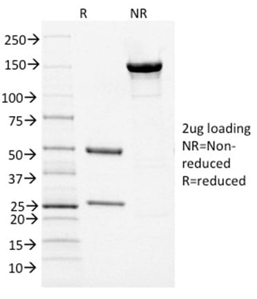 PAX5 / BSAP Monoclonal Mouse Antibody (PCRP-PAX5-1B1)