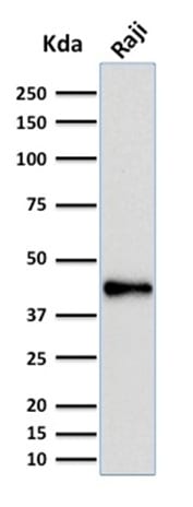 PAX5 / BSAP Monoclonal Mouse Antibody (PCRP-PAX5-1B1)