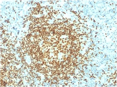 PAX5 / BSAP Monoclonal Mouse Antibody (PCRP-PAX5-1B7)