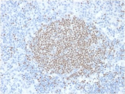 PAX5 / BSAP Monoclonal Mouse Antibody (PCRP-PAX5-1B7)
