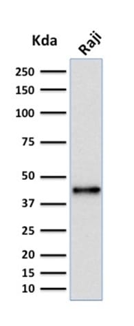 PAX5 / BSAP Monoclonal Mouse Antibody (PCRP-PAX5-1B7)