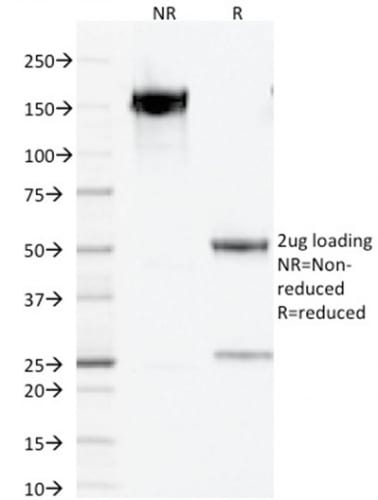 PAX5 / BSAP Monoclonal Mouse Antibody (PCRP-PAX5-1B7)
