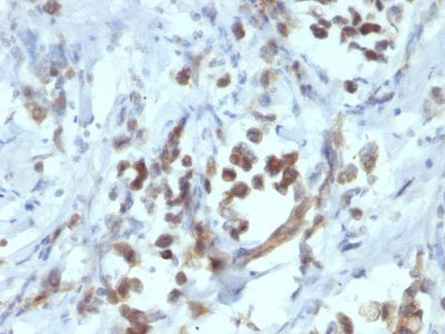 PAX6 Monoclonal Mouse Antibody (PAX6/1166)