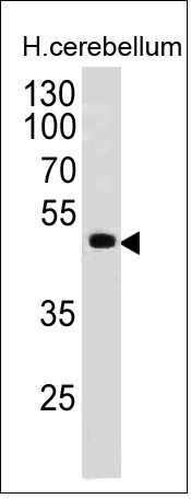 PAX6 Monoclonal Mouse Antibody (PAX6/498)