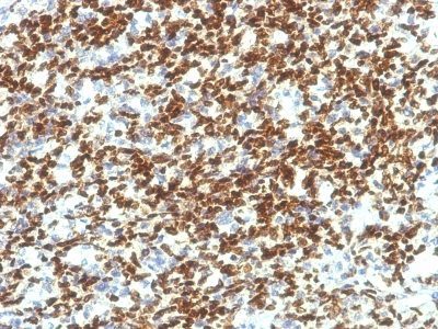 PAX7 Monoclonal Mouse Antibody (PAX7/1187)