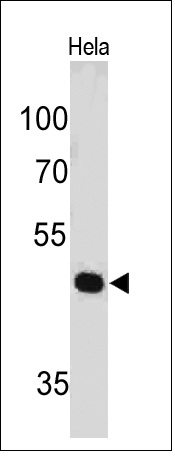 PAX7 Monoclonal Mouse Antibody (PAX7/497)