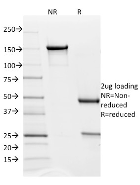 PD-L2 / PDCD1LG2 / CD273 Monoclonal Mouse Antibody (PDL2/1850)
