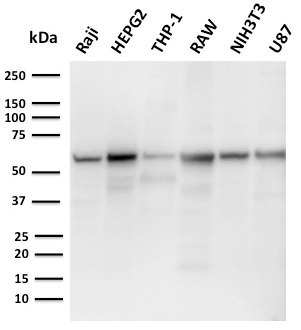 PD-L2 / PDCD1LG2 / CD273 Monoclonal Mouse Antibody (PDL2/2676)