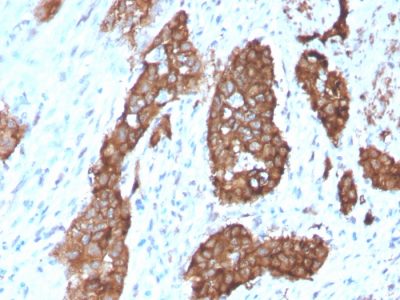 PDZ and LIM Domain 1 Monoclonal Mouse Antibody (CPTC-PDLIM1-1)