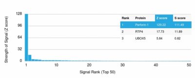 Perforin-1 Monoclonal Mouse Antibody (PRF1/2467)