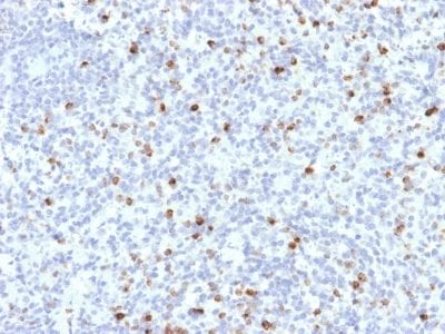 Perforin-1 Monoclonal Mouse Antibody (PRF1/2468)