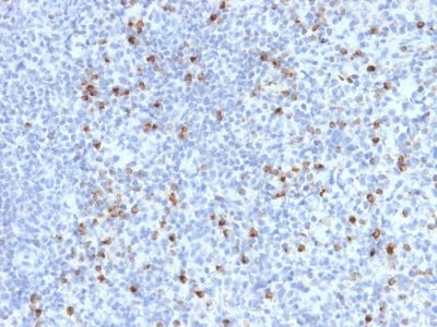 Perforin-1 Monoclonal Mouse Antibody (PRF1/2470)