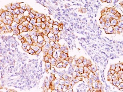 Phosphotyrosine Monoclonal Mouse Antibody (PY20)