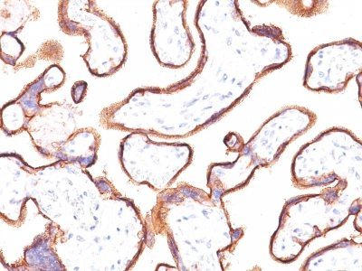 PLAP Monoclonal Mouse Antibody (ALPP/870)
