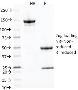 PLAP Monoclonal Mouse Antibody (ALPP/870)