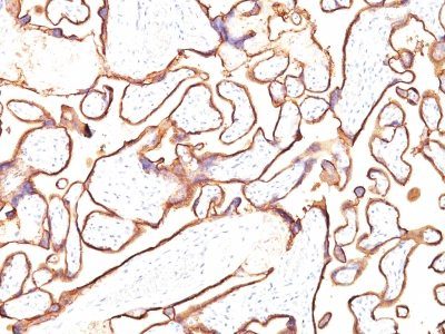 PLAP Monoclonal Mouse Antibody (PL8-F6)