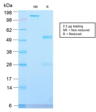 PLAP Recombinant Monoclonal Rabbit Antibody (ALPP/2899R)