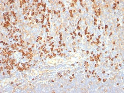 Plasma Cell Marker Monoclonal Mouse Antibody (LIV3G11, same as 7B18)