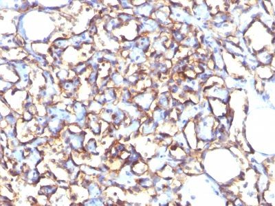 Podocalyxin Monoclonal Mouse Antibody (3D3)