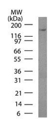 Podocalyxin Monoclonal Mouse Antibody (3D3)