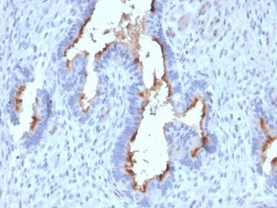 Podocalyxin Monoclonal Mouse Antibody (PODXL/2185)