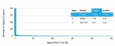 Podocalyxin Monoclonal Mouse Antibody (PODXL/2185)
