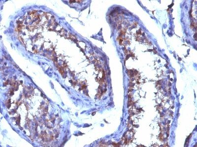 Progesterone Monoclonal Mouse Antibody (6-5E-3F)