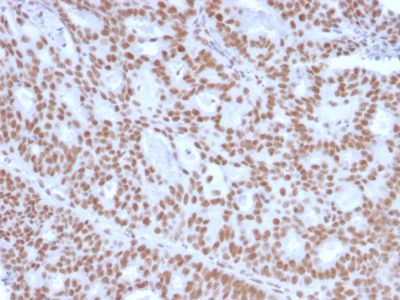 Progesterone Receptor Monoclonal Mouse Antibody (PGR/2694)