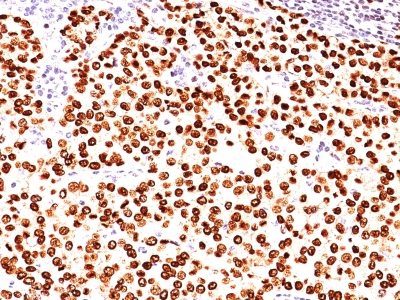 Progesterone Receptor Monoclonal Mouse Antibody (PR484)