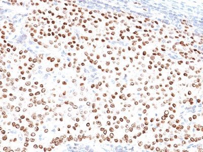Progesterone Receptor Monoclonal Mouse Antibody (PR500)