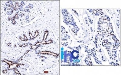 Progesterone Receptor Monoclonal Mouse Antibody (PR501)