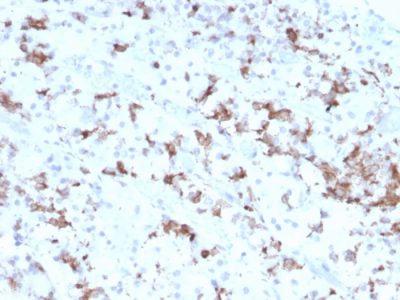 Prolactin Monoclonal Mouse Antibody (PRL/2641)