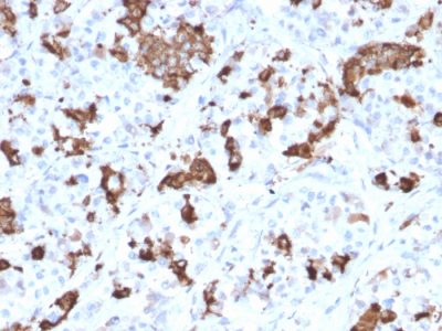 Prolactin Monoclonal Mouse Antibody (PRL/2644)