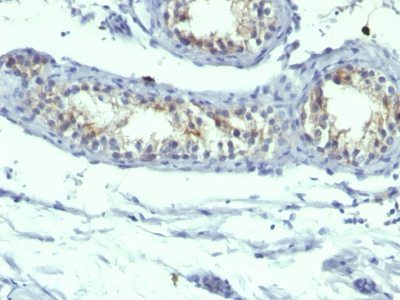 Prolactin Receptor Monoclonal Mouse Antibody (B6.2 + PRLR742)