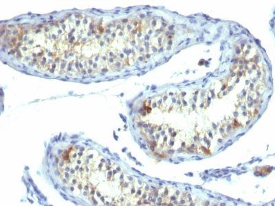 Prolactin Receptor Monoclonal Mouse Antibody (B6.2)
