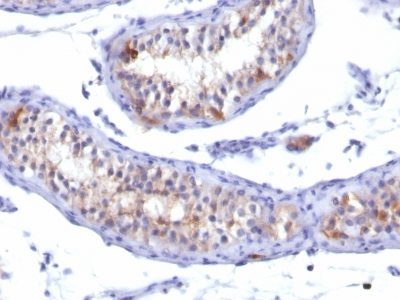 Prolactin Receptor Monoclonal Mouse Antibody (PRLR/742)