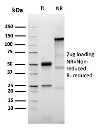 Prolactin Receptor Recombinant Monoclonal Rabbit Antibody (PRLR/3785R)