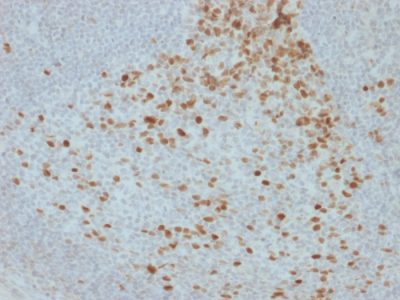 Proliferation Marker Monoclonal Mouse Antibody (JC1)