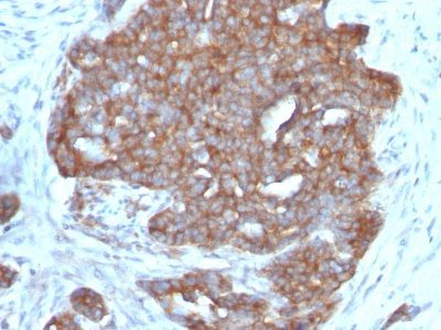 pS2 / pNR-2 / TFF1 Monoclonal Mouse Antibody (TFF1/1091)