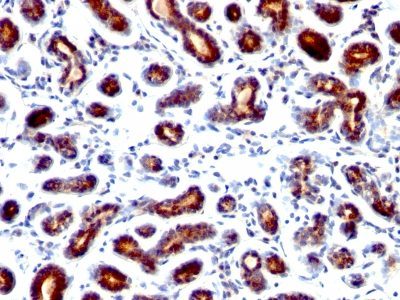 pS2 / pNR-2 / TFF1 Monoclonal Mouse Antibody (TFF1/1091)