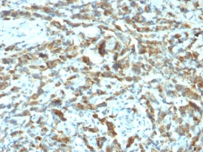 pS2 / pNR-2 / TFF1 Monoclonal Mouse Antibody (TFF1/2133)