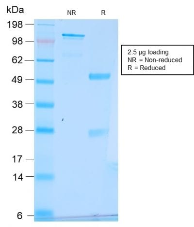 pS2 / pNR-2 / TFF1 Recombinant Monoclonal Rabbit Antibody (TFF1/2969R)